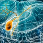 Study Observes Predictor of Response to Ursodeoxycholic Acid Treatment for PBC