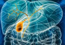 Study Observes Predictor of Response to Ursodeoxycholic Acid Treatment for PBC