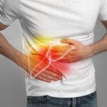 Histological Stage Is Linked to Risk of Complications in Patients With PBC