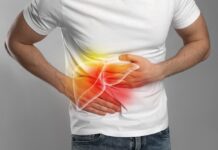 Histological Stage Is Linked to Risk of Complications in Patients With PBC