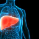 Diabetes Impacts Survival Outcomes for Patients With PBC