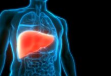 Diabetes Impacts Survival Outcomes for Patients With PBC